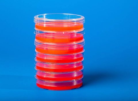 RCSI debuts ‘promising’ new sepsis drug treatment